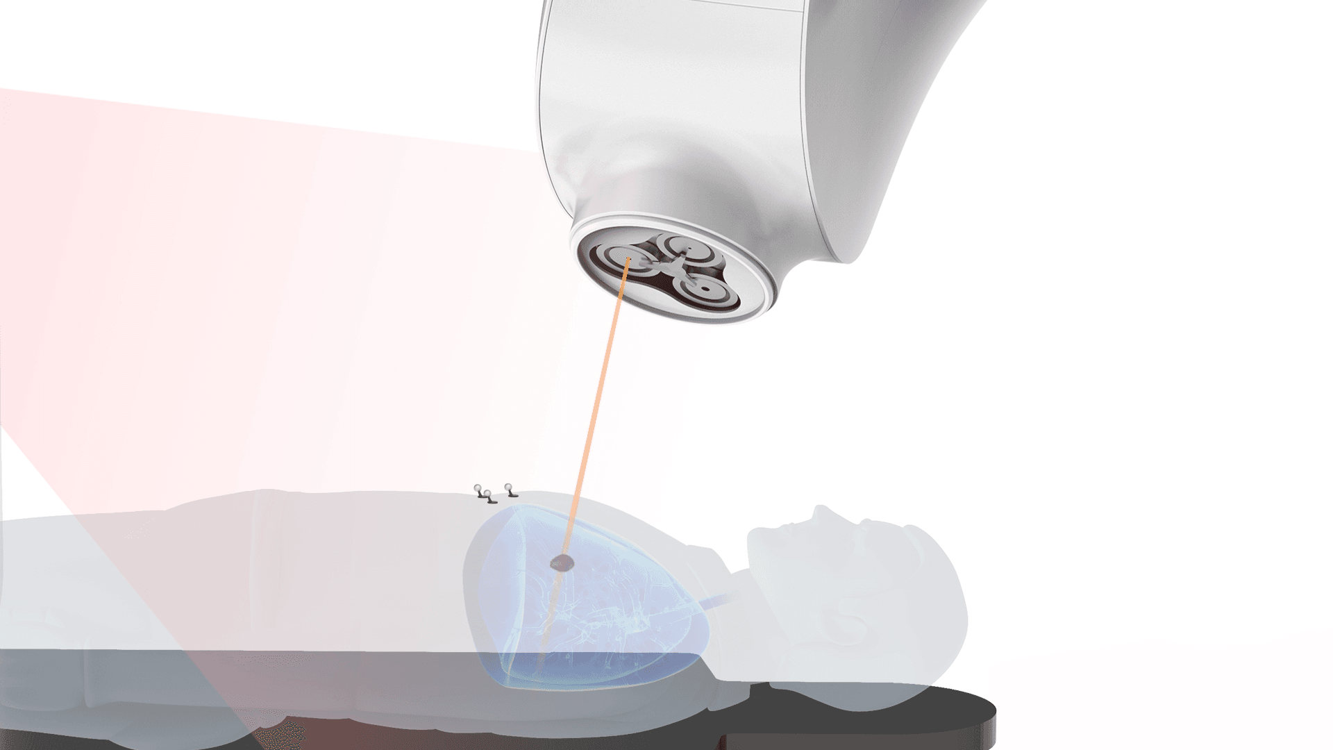Dynamic Target Tracking Irradiation